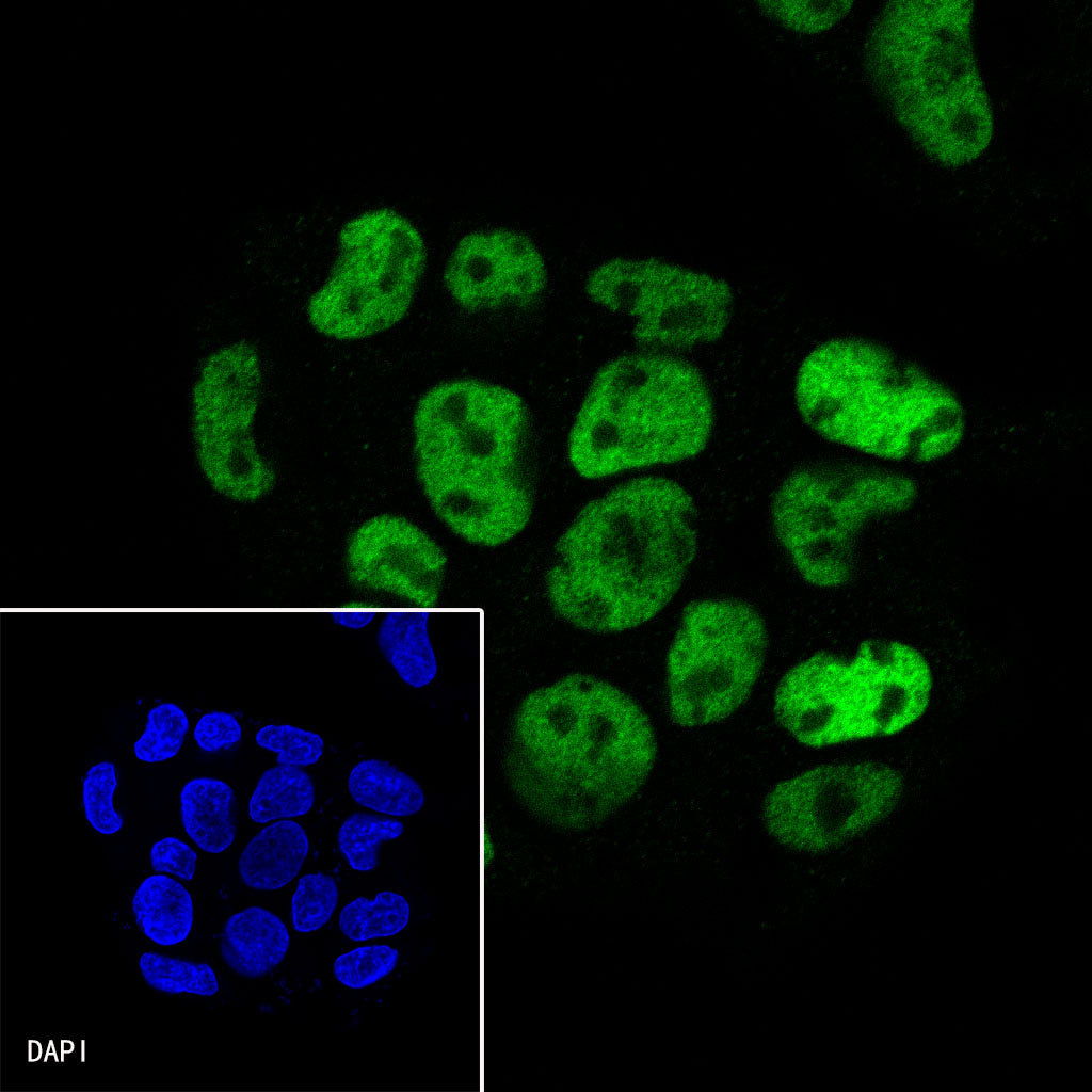 HNF4α Recombinant Rabbit mAb (SDT-373-64)
