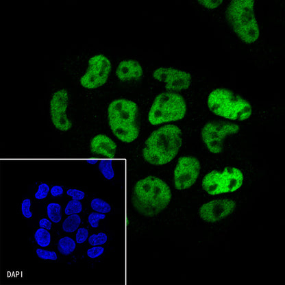 HNF4α Recombinant Rabbit mAb (SDT-373-64)
