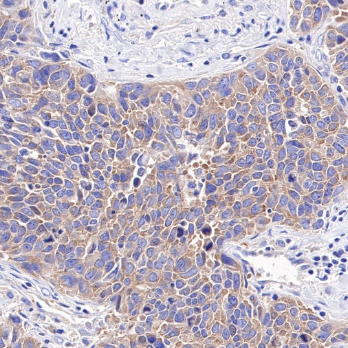 S-RMab®HDAC6 Recombinant Rabbit mAb (S-R338)