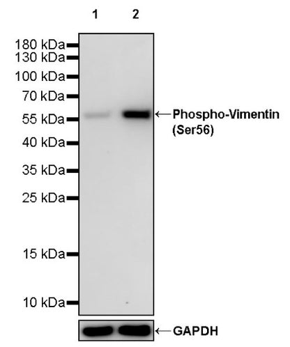 Phospho-Vimentin (Ser56) Recombinant Rabbit mAb (S-2135-5)