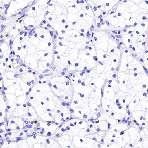 CD2 Recombinant Rabbit mAb (SDT-R261)