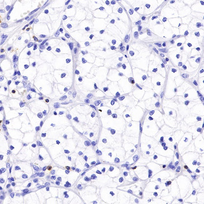 CD2 Recombinant Rabbit mAb (SDT-R261)