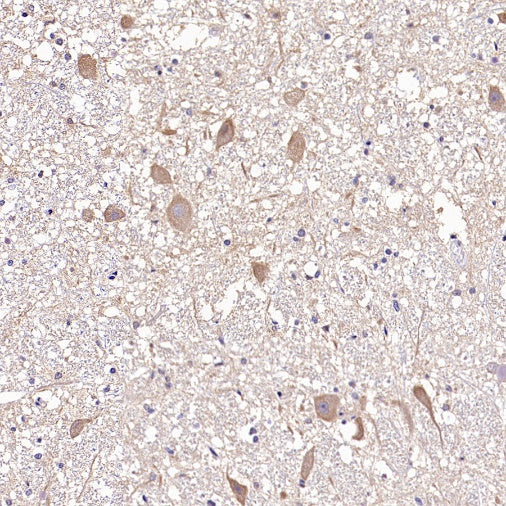 BSCL2/Seipin Recombinant Rabbit mAb (S-1669-135)