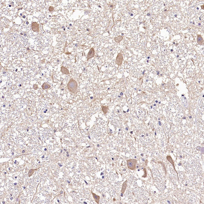 BSCL2/Seipin Recombinant Rabbit mAb (S-1669-135)
