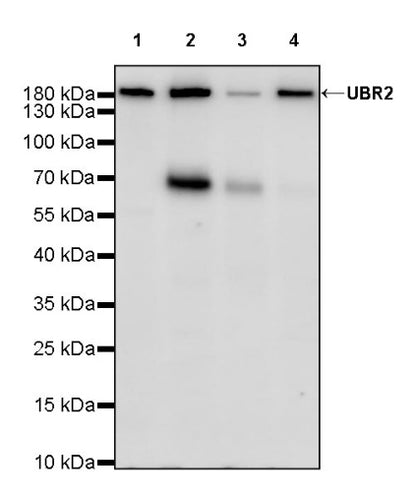 UBR2 Recombinant Rabbit mAb (S-2041-163)