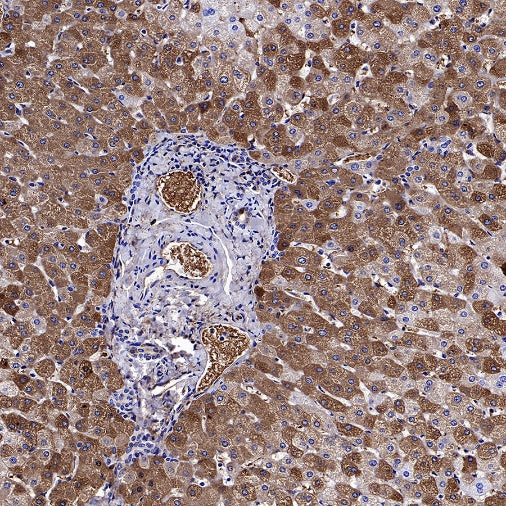 LY6E/SCA-2 Recombinant Rabbit mAb (S-2681-56)