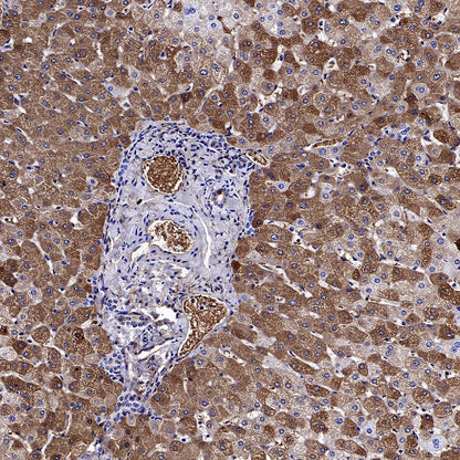LY6E/SCA-2 Recombinant Rabbit mAb (S-2681-56)