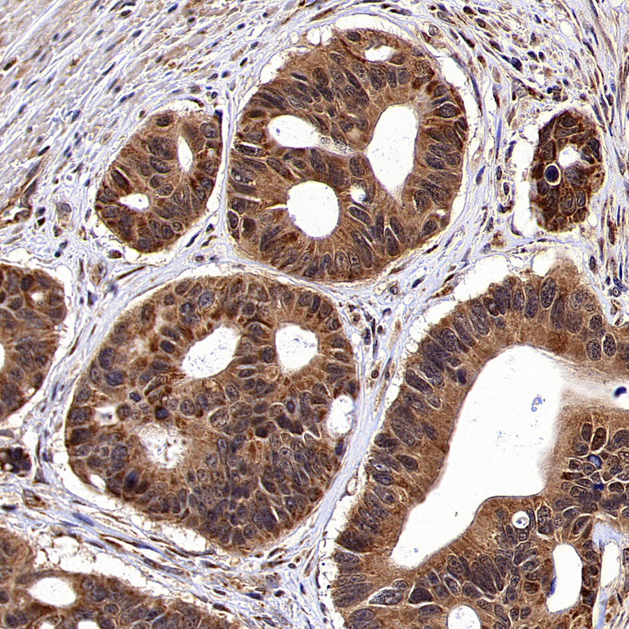 ACSS2 Recombinant Rabbit mAb (S-4117-9)