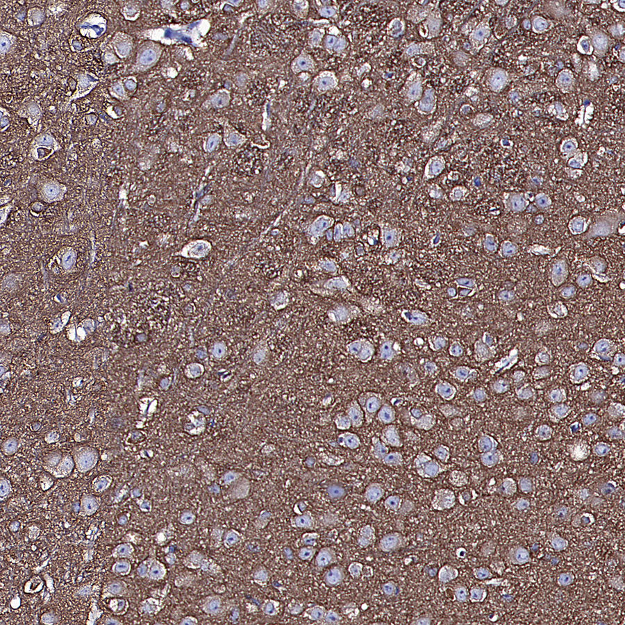 TUBA1A Rabbit Polyclonal Antibody