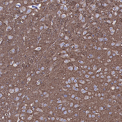 TUBA1A Rabbit Polyclonal Antibody