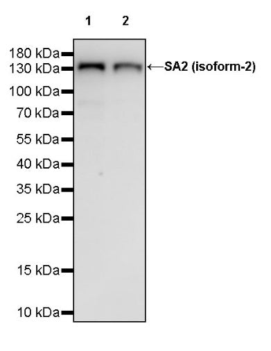 SA2 (isoform-2) Recombinant Rabbit mAb (S-1461-231)