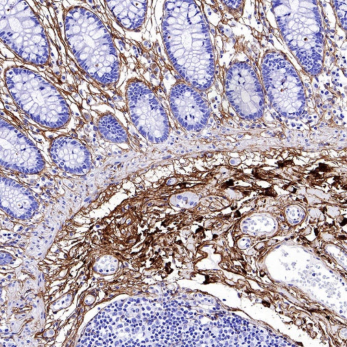 Collagen III Recombinant Mouse mAb (S-3838)