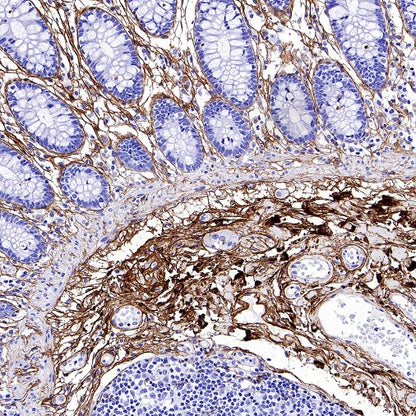Collagen III Recombinant Mouse mAb (S-3838)