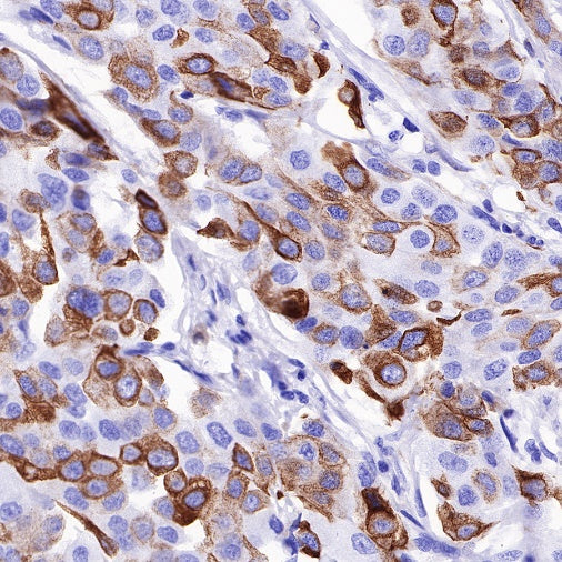 MUC4 Recombinant Rabbit mAb (SDT-R228)