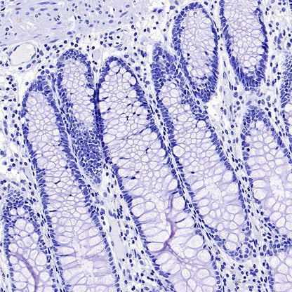 PMEL/Melanoma gp100 Recombinant Rabbit mAb (SDT-3393)