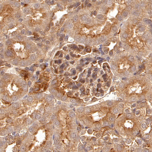 RhoA Recombinant Rabbit mAb (S-1310-159)