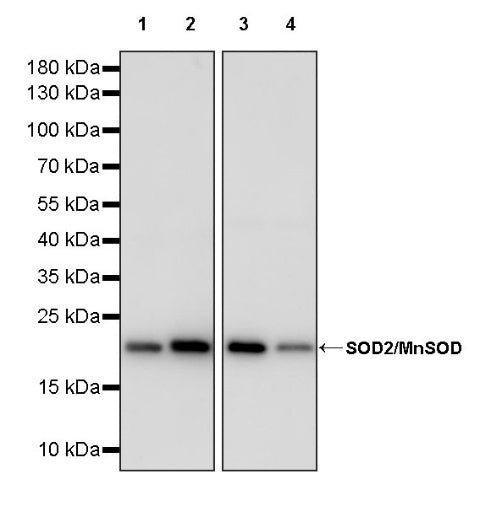 SOD2/MnSOD Rabbit Polyclonal Antibody