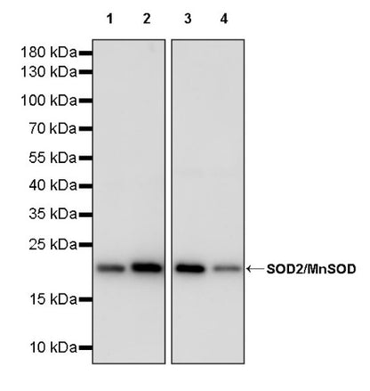 SOD2/MnSOD Rabbit Polyclonal Antibody