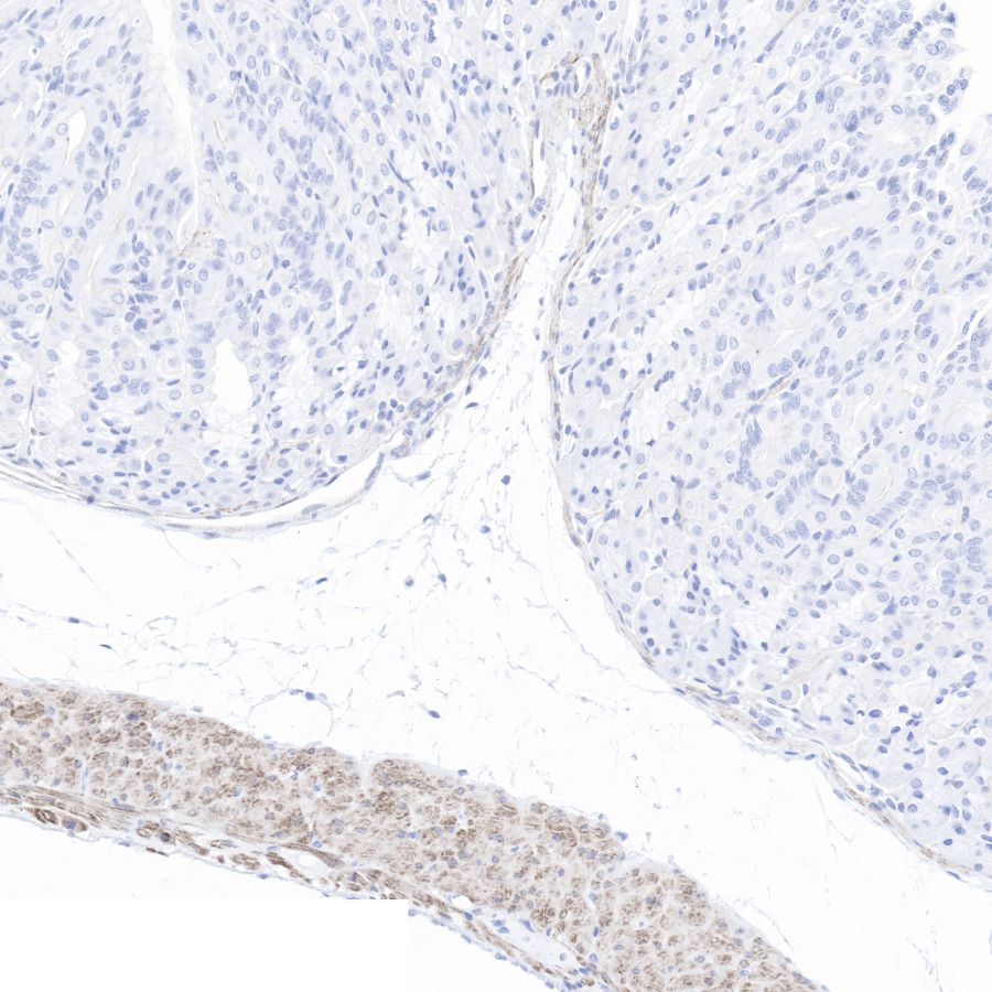 pan (alpha) actin Recombinant Rabbit mAb (SDT-044-17)