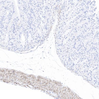 pan (alpha) actin Recombinant Rabbit mAb (SDT-044-17)