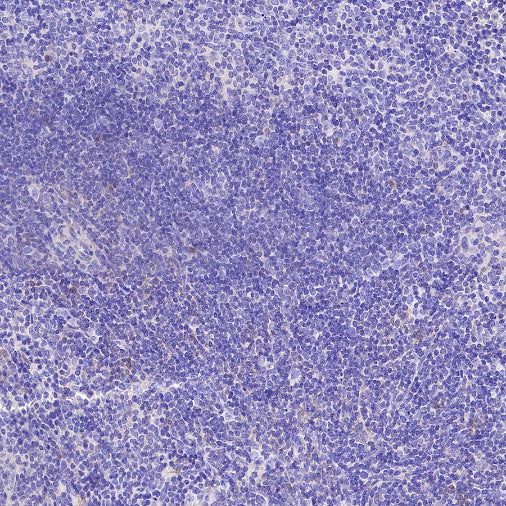 VGLUT3 Recombinant Rabbit mAb (S-2430-26)