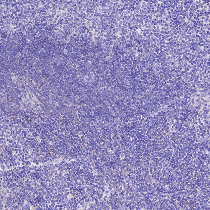 VGLUT3 Recombinant Rabbit mAb (S-2430-26)