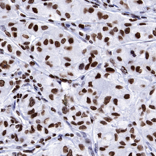 PARP1 Recombinant Rabbit mAb (S-R299)