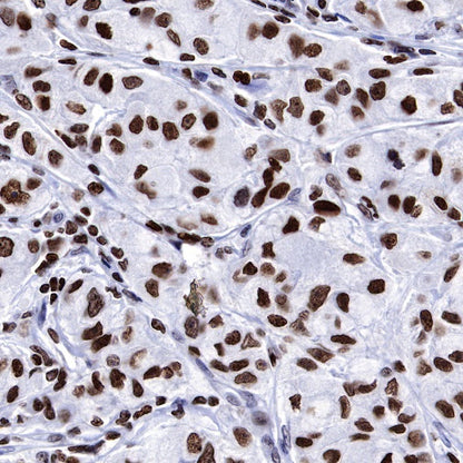 PARP1 Recombinant Rabbit mAb (S-R299)