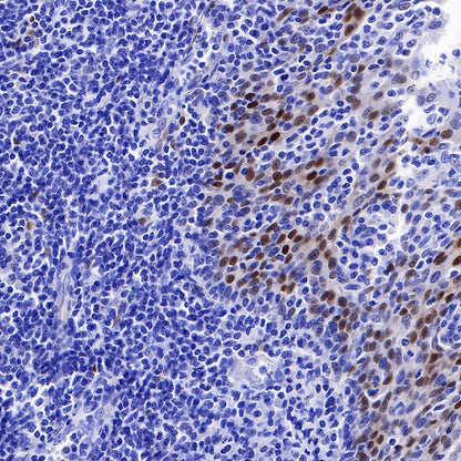 Cyclin D1 Recombinant Rabbit mAb (SDT-R423)