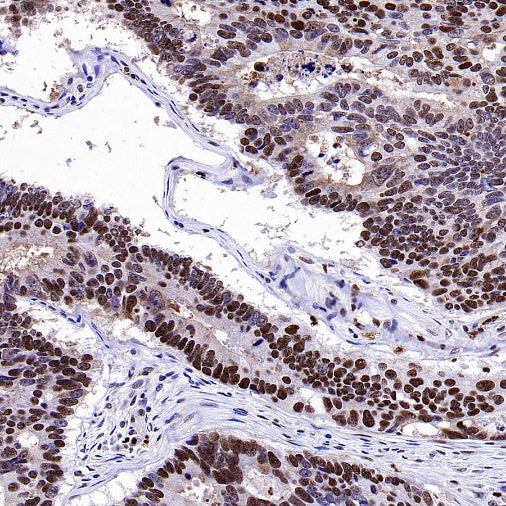 TKT Rabbit Polyclonal Antibody