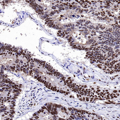 TKT Rabbit Polyclonal Antibody