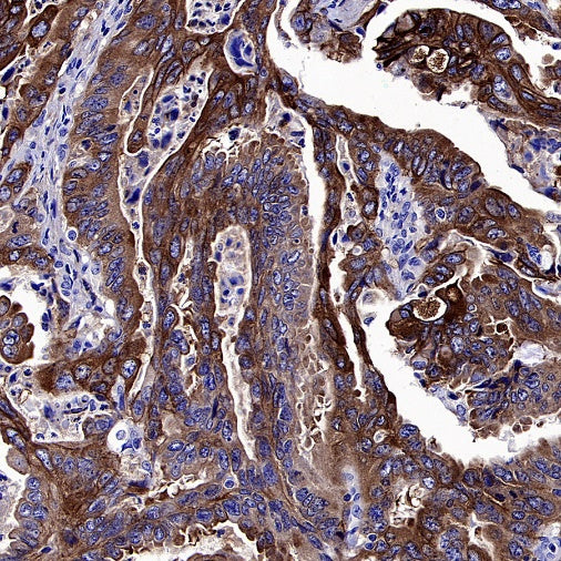 LY6E/SCA-2 Recombinant Rabbit mAb (S-2681-56)