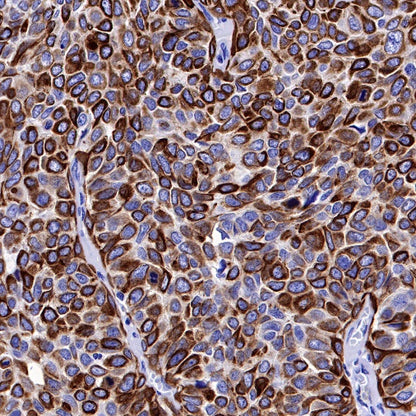 CK-13 Recombinant Rabbit mAb (SDT-641-41)