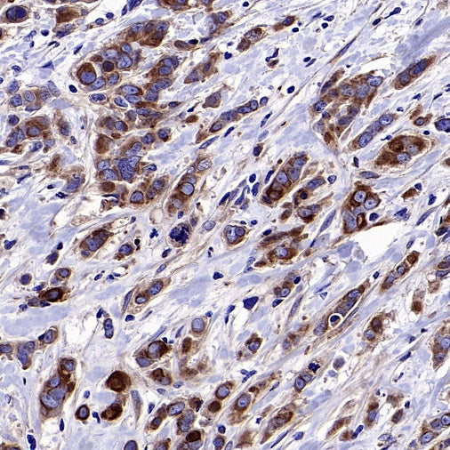 LY6E/SCA-2 Recombinant Rabbit mAb (S-2681-56)