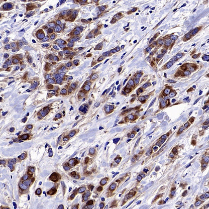 LY6E/SCA-2 Recombinant Rabbit mAb (S-2681-56)