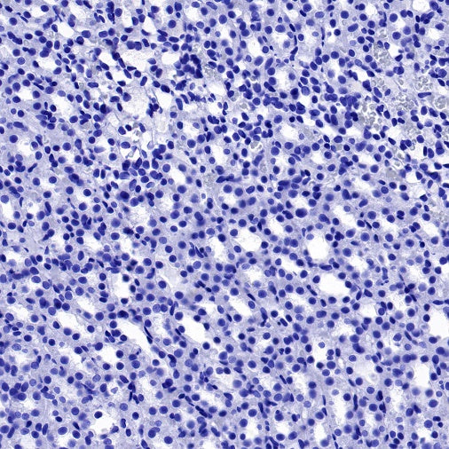 Aquaporin 5/AQP5 Recombinant Rabbit mAb (S-1610-43)