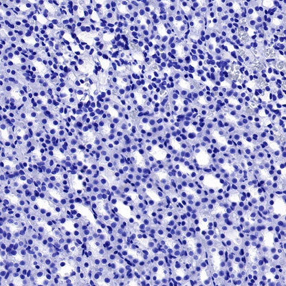 Aquaporin 5/AQP5 Recombinant Rabbit mAb (S-1610-43)