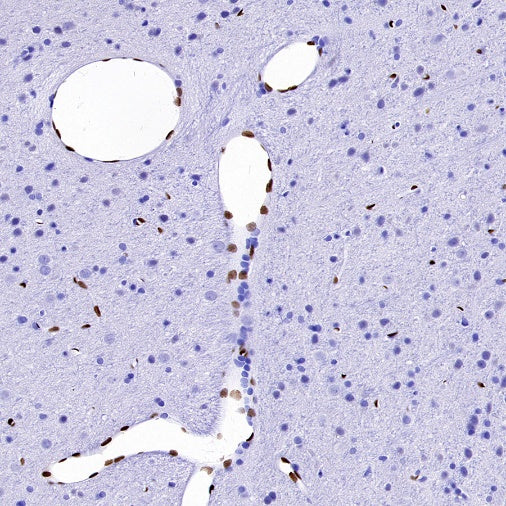 FOXC1 Recombinant Rabbit mAb (S-1607-142)