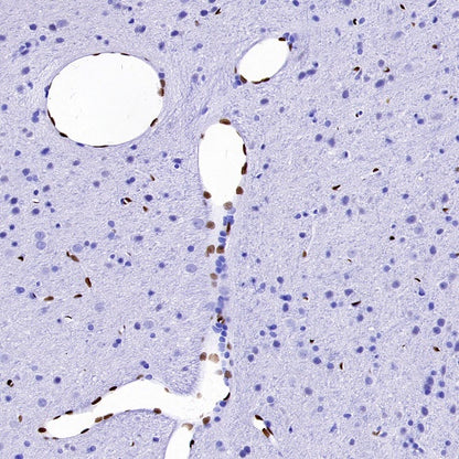 FOXC1 Recombinant Rabbit mAb (S-1607-142)