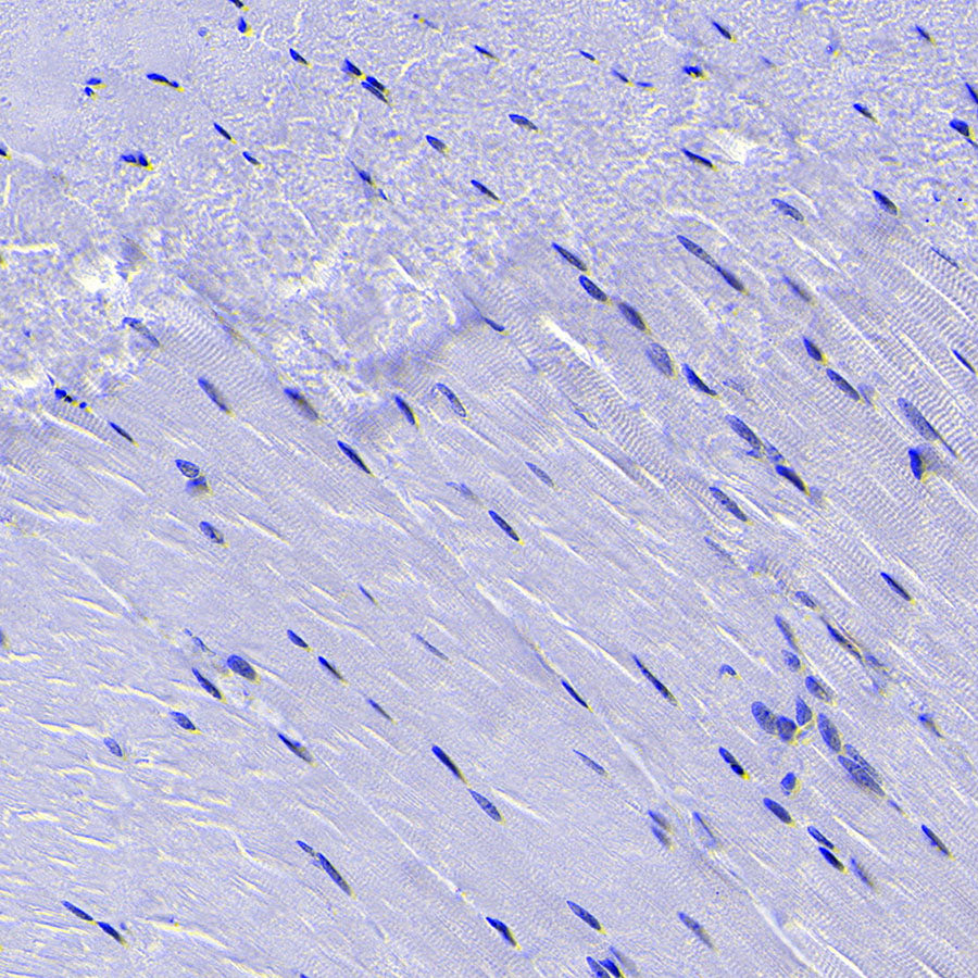 SCTR Recombinant Rabbit mAb (S-3949-52)