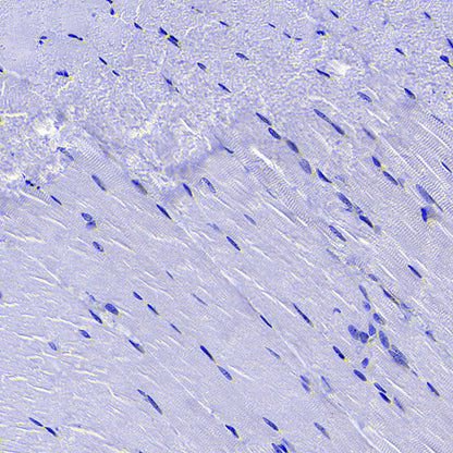 SCTR Recombinant Rabbit mAb (S-3949-52)