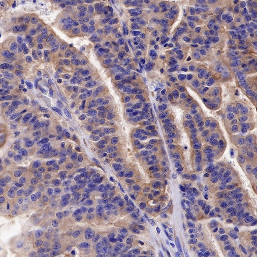 Calpastatin Recombinant Rabbit mAb (S-R184)