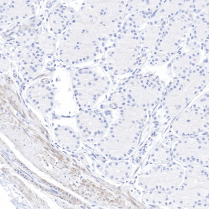 pan (alpha) actin Recombinant Rabbit mAb (SDT-044-17)