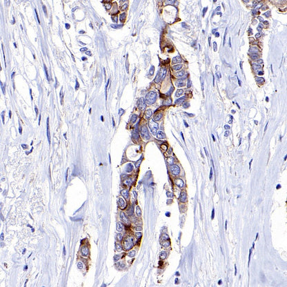 IGFBP2 Recombinant Rabbit mAb (S-808-24)