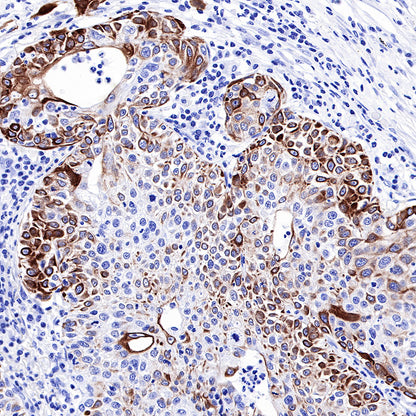 Keratin 17 Recombinant Rabbit mAb (SDT-011-43)