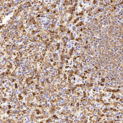 NOX2/gp91phox Recombinant Rabbit mAb (S-2974-75)