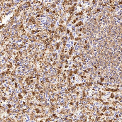 NOX2/gp91phox Recombinant Rabbit mAb (S-2974-75)