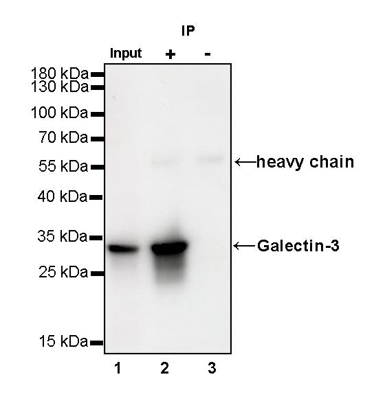 Galectin-3 Recombinant Rabbit mAb (SDT-370-111)