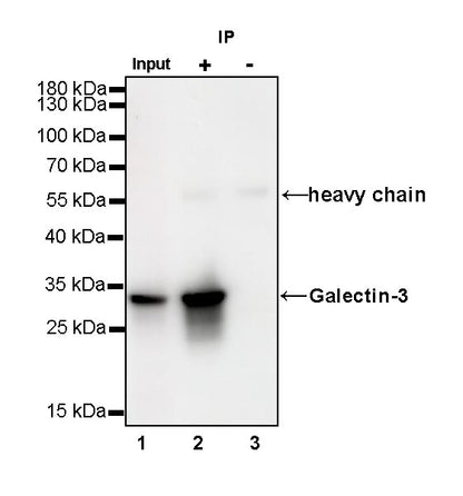 Galectin-3 Recombinant Rabbit mAb (SDT-370-111)