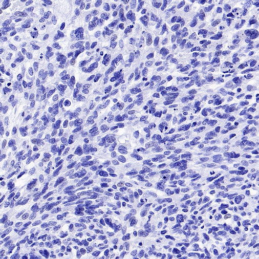 TMEM16A Recombinant Rabbit mAb (SDT-2179-68)